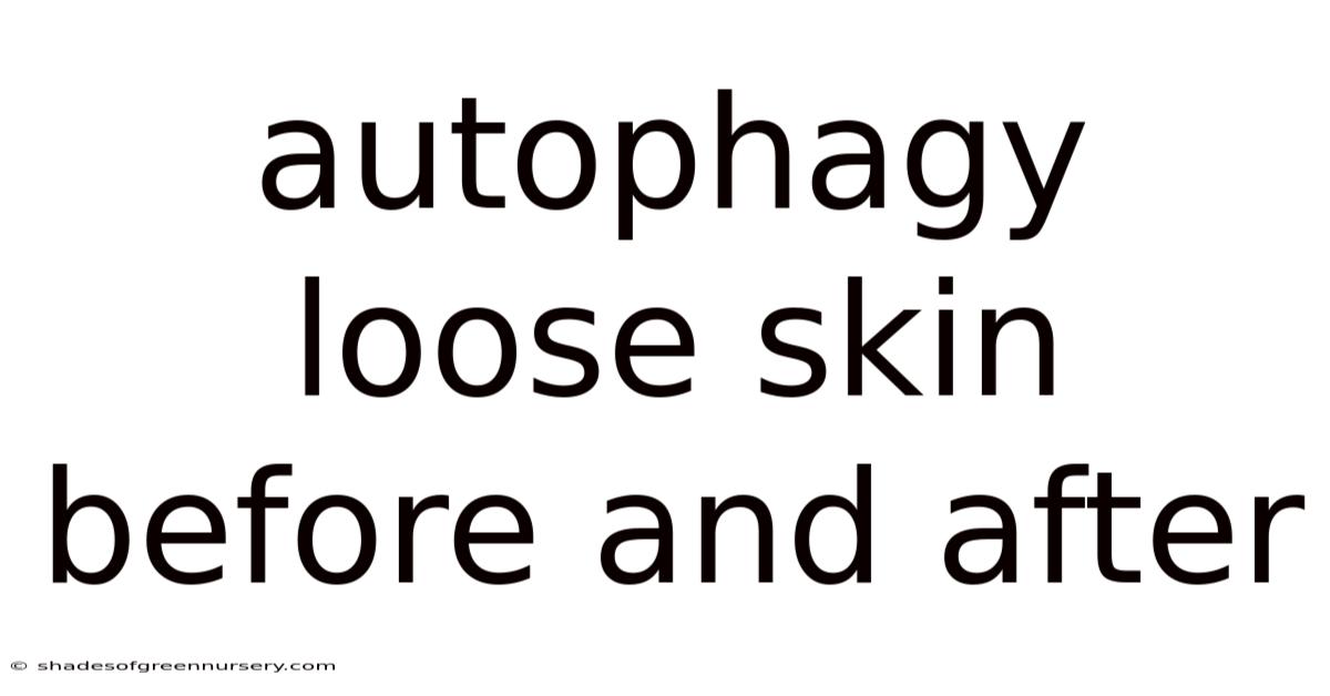 Autophagy Loose Skin Before And After