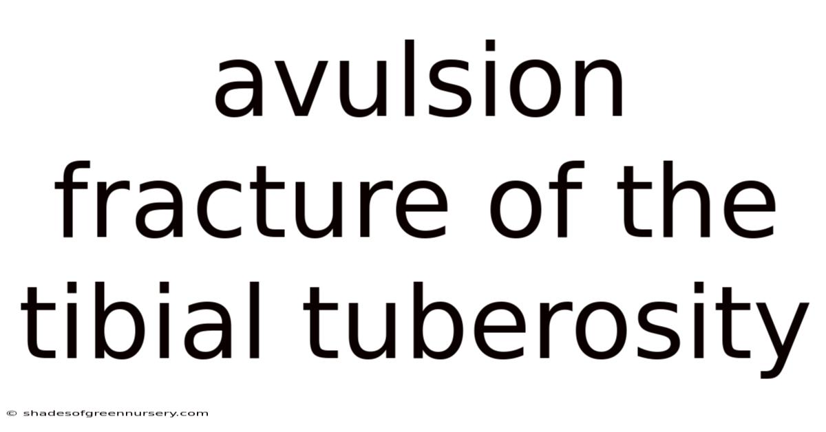 Avulsion Fracture Of The Tibial Tuberosity