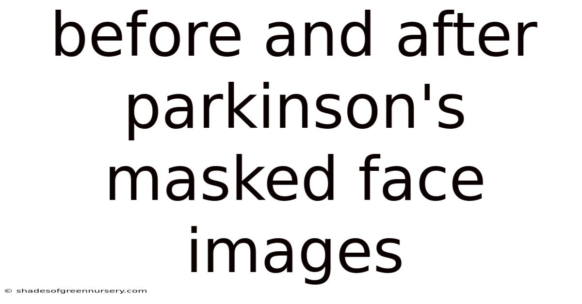 Before And After Parkinson's Masked Face Images