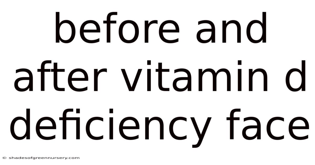 Before And After Vitamin D Deficiency Face