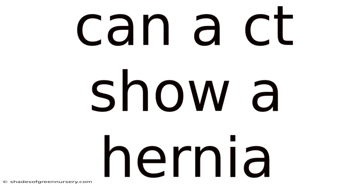 Can A Ct Show A Hernia