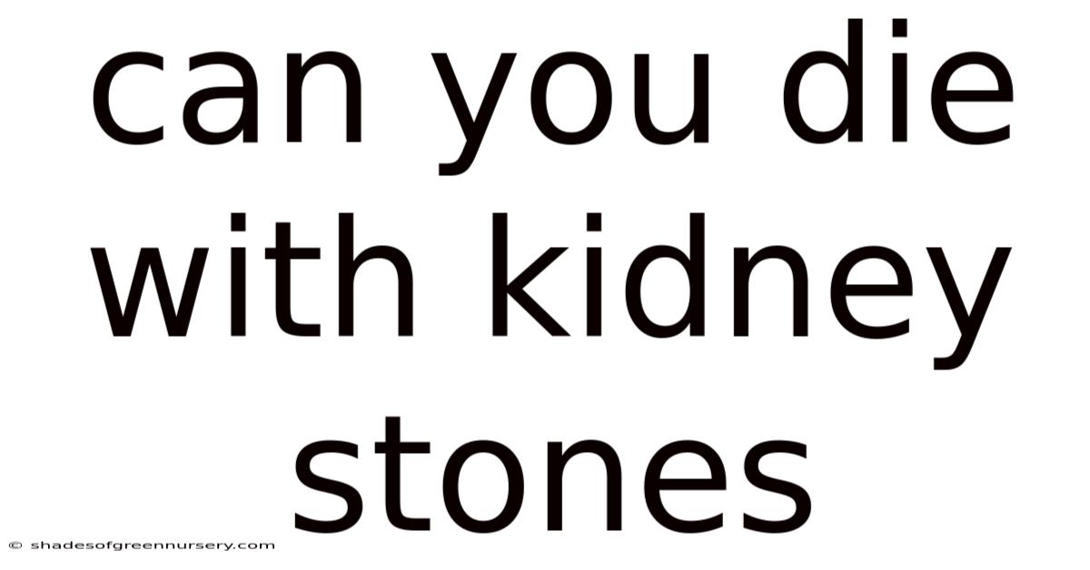 Can You Die With Kidney Stones