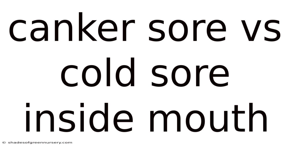 Canker Sore Vs Cold Sore Inside Mouth