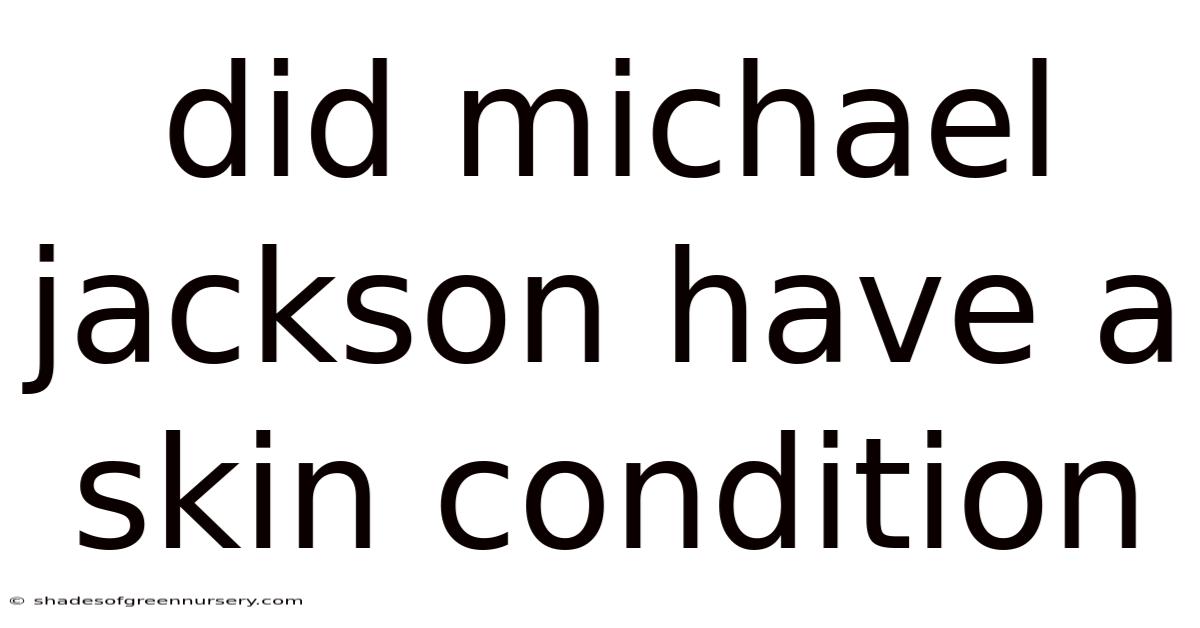 Did Michael Jackson Have A Skin Condition