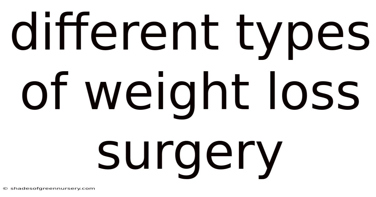 Different Types Of Weight Loss Surgery