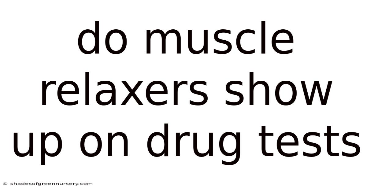 Do Muscle Relaxers Show Up On Drug Tests