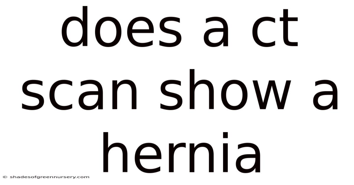 Does A Ct Scan Show A Hernia