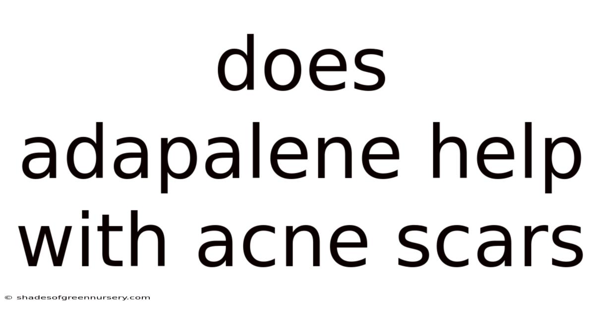 Does Adapalene Help With Acne Scars