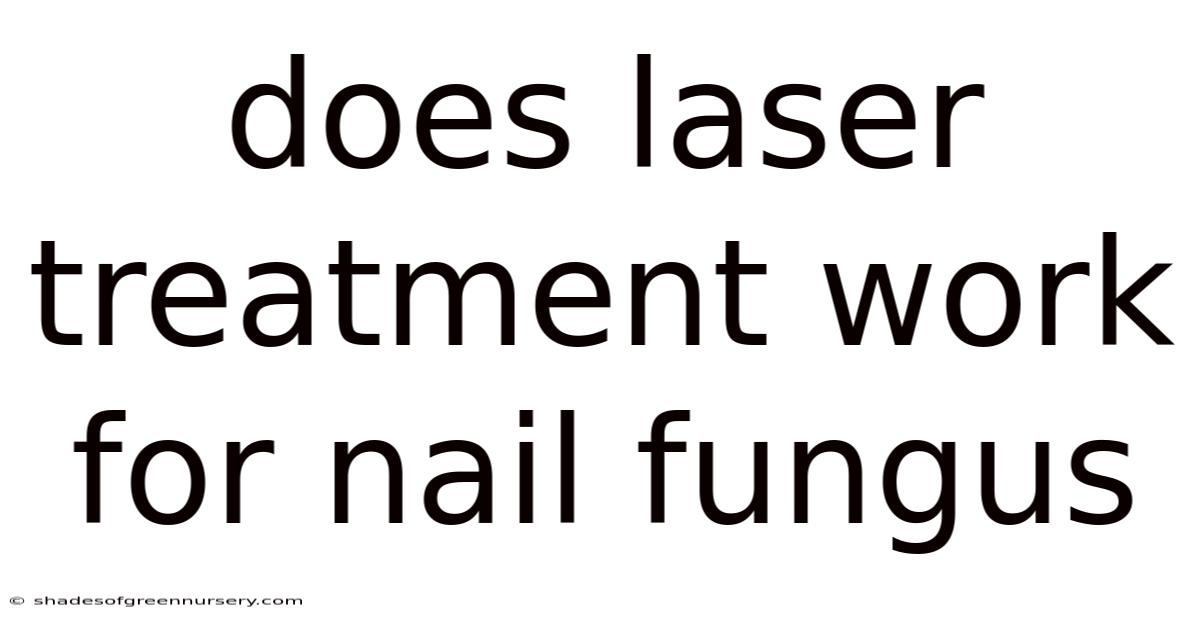 Does Laser Treatment Work For Nail Fungus