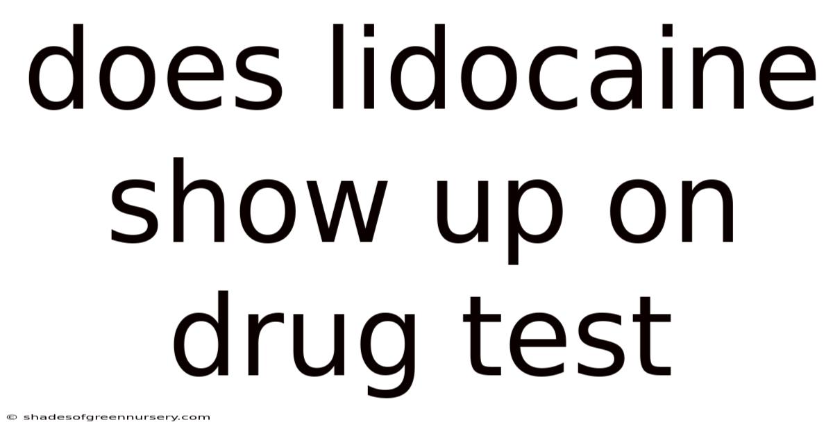Does Lidocaine Show Up On Drug Test