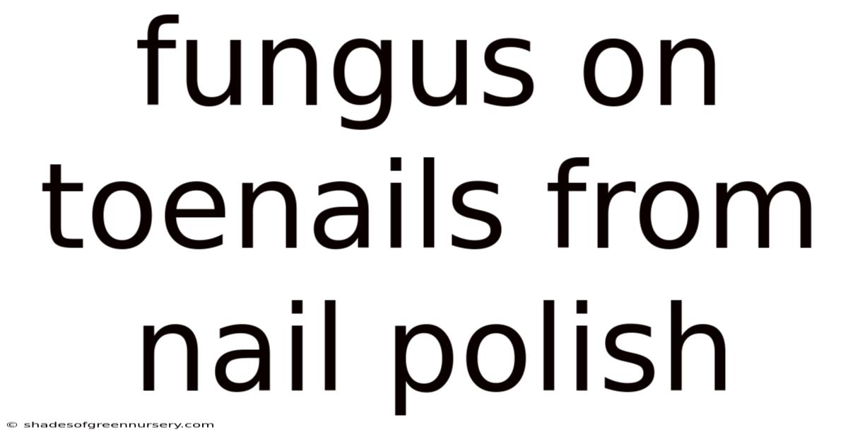 Fungus On Toenails From Nail Polish