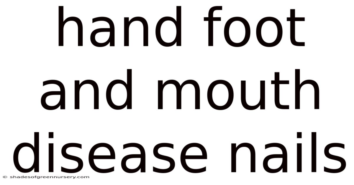 Hand Foot And Mouth Disease Nails