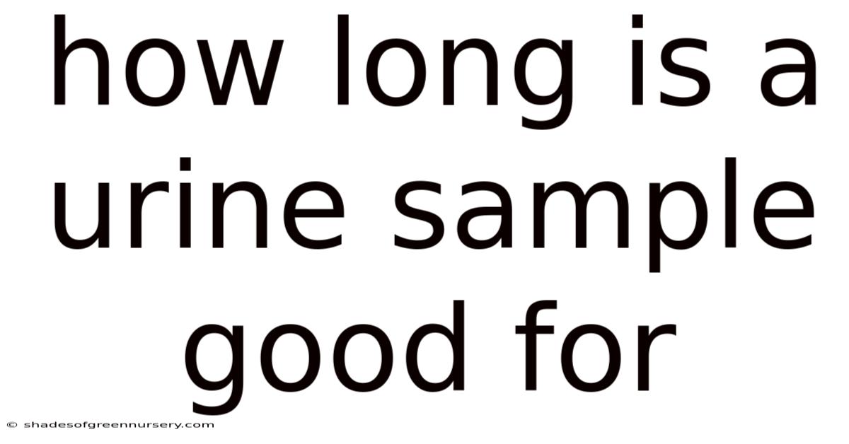 How Long Is A Urine Sample Good For