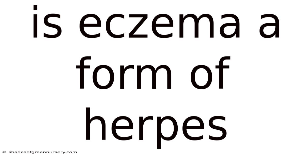 Is Eczema A Form Of Herpes
