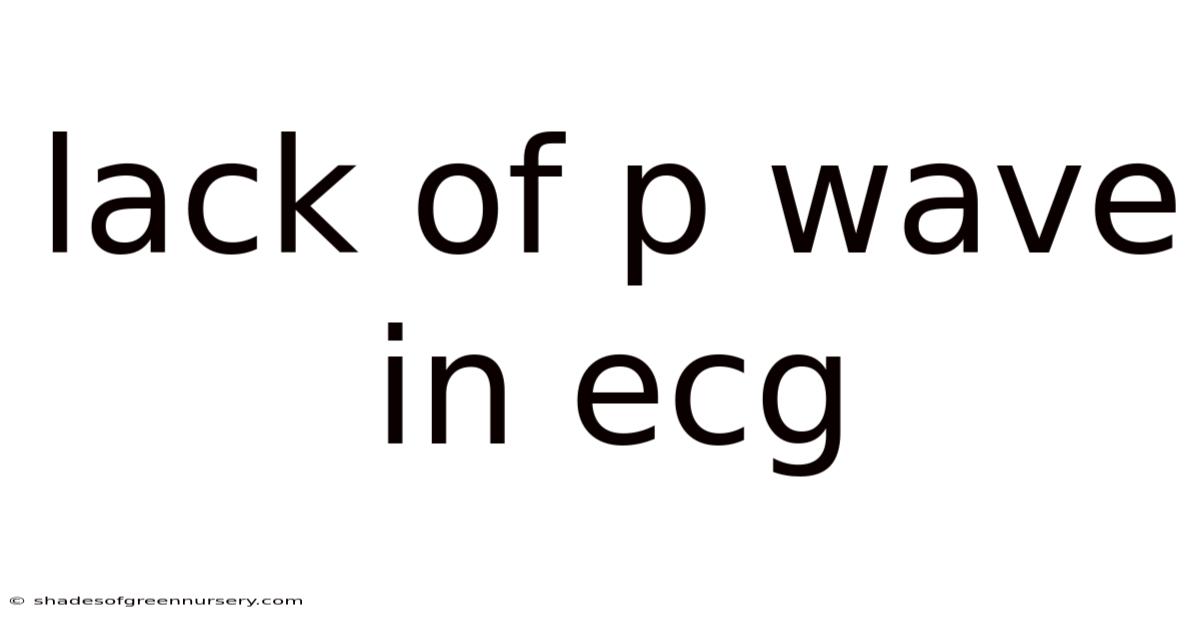 Lack Of P Wave In Ecg