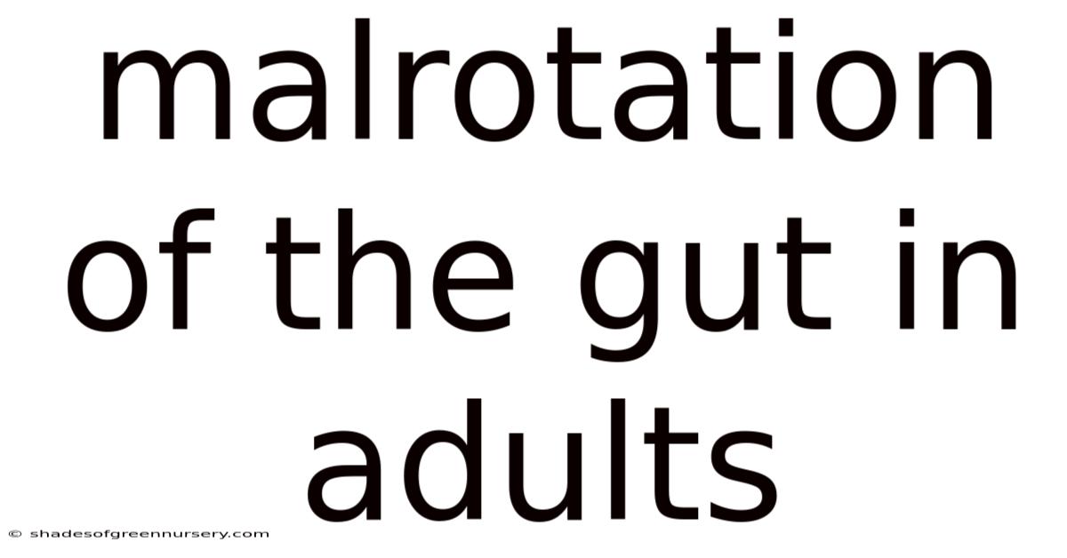 Malrotation Of The Gut In Adults