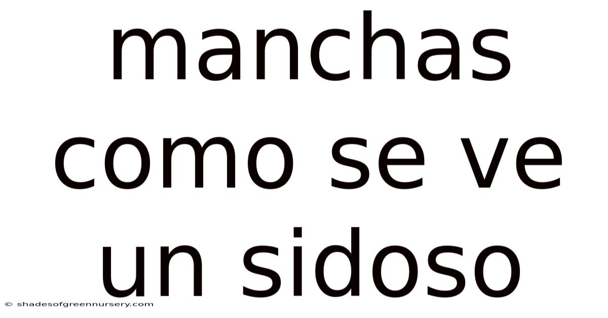 Manchas Como Se Ve Un Sidoso