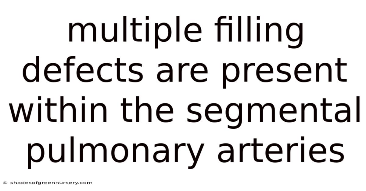 Multiple Filling Defects Are Present Within The Segmental Pulmonary Arteries