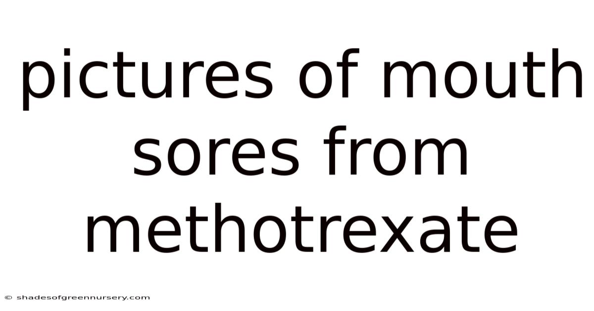 Pictures Of Mouth Sores From Methotrexate