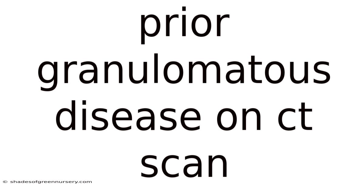 Prior Granulomatous Disease On Ct Scan