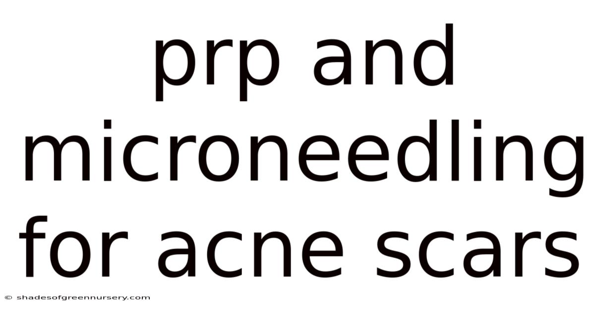 Prp And Microneedling For Acne Scars