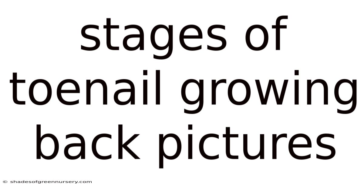 Stages Of Toenail Growing Back Pictures