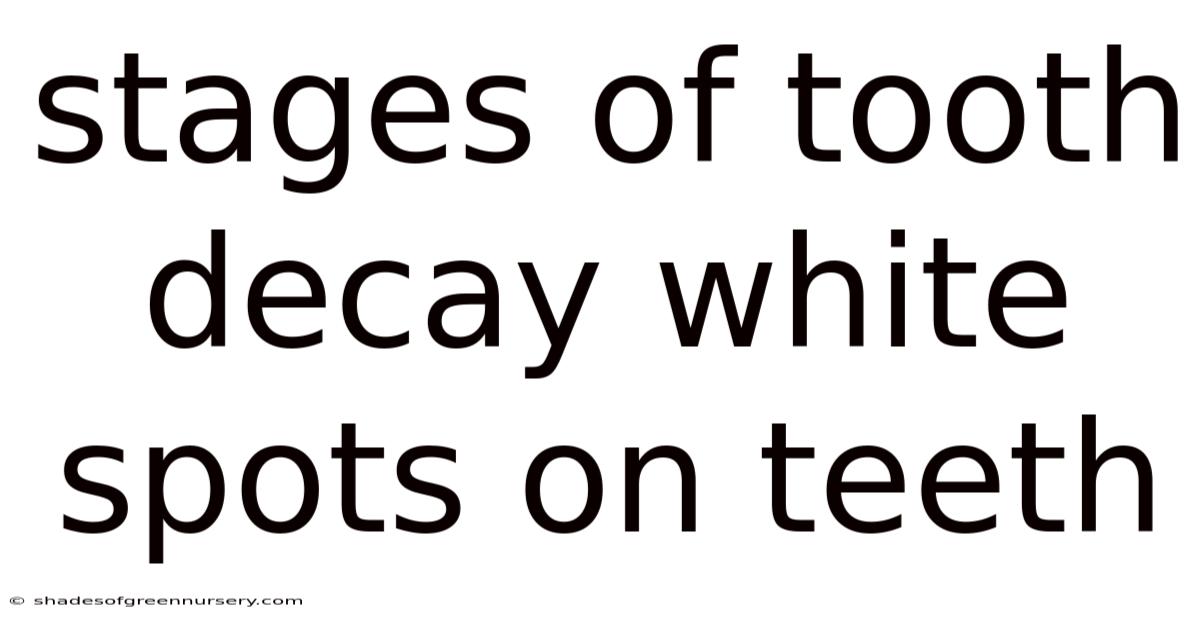 Stages Of Tooth Decay White Spots On Teeth