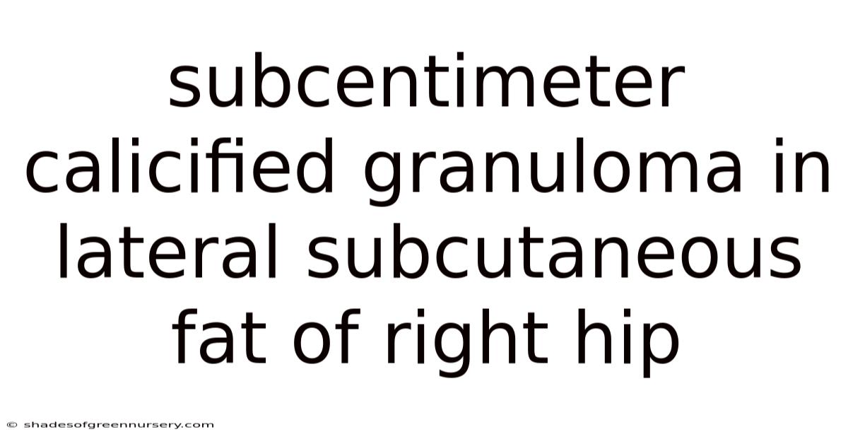 Subcentimeter Calicified Granuloma In Lateral Subcutaneous Fat Of Right Hip