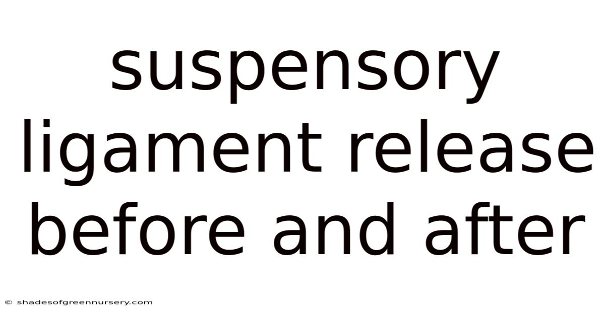 Suspensory Ligament Release Before And After