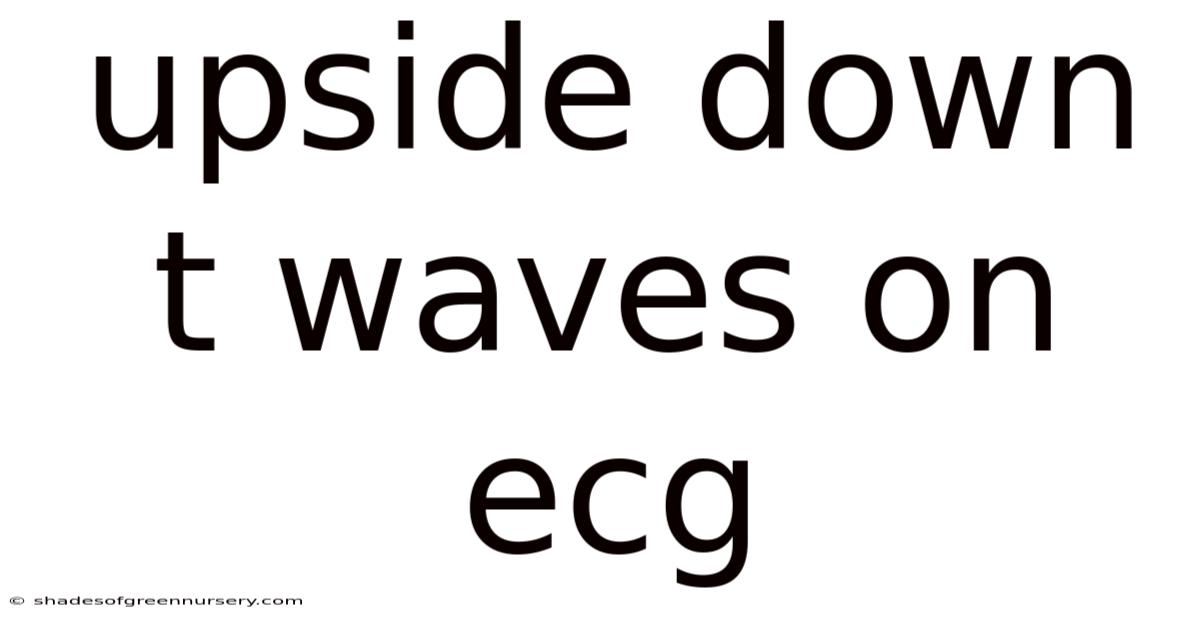 Upside Down T Waves On Ecg