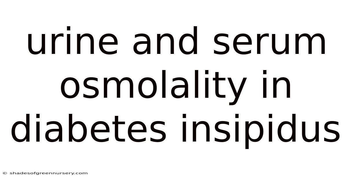Urine And Serum Osmolality In Diabetes Insipidus