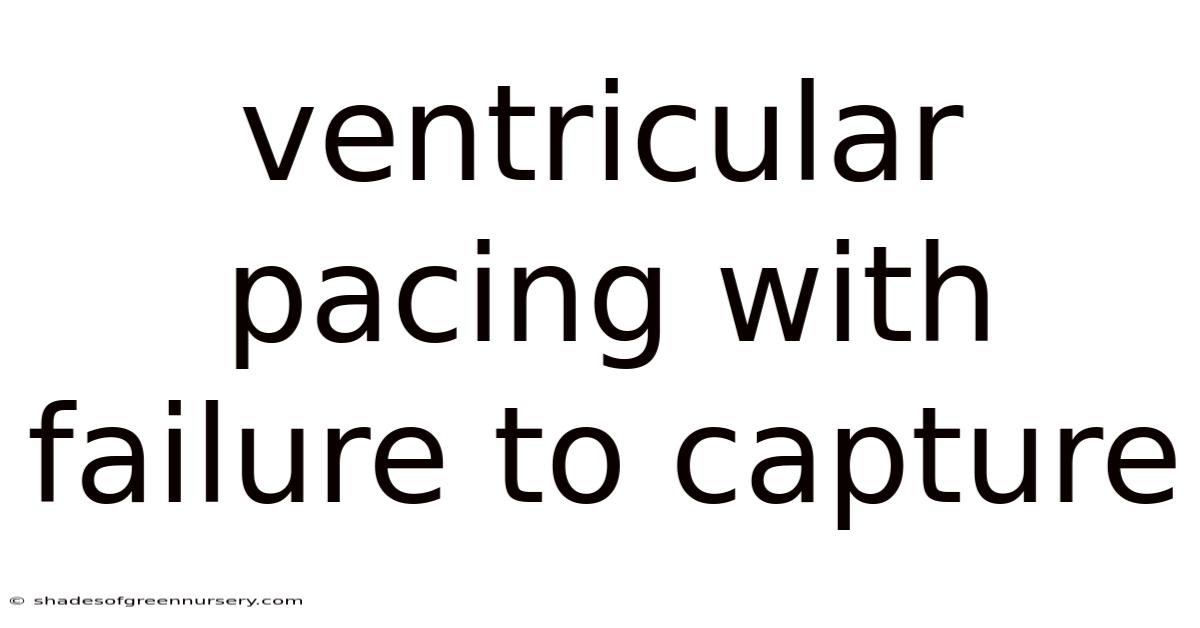 Ventricular Pacing With Failure To Capture
