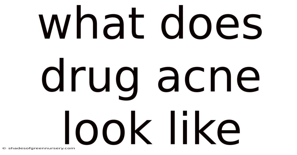 What Does Drug Acne Look Like