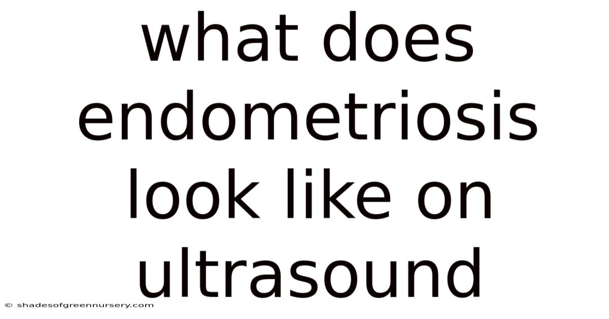 What Does Endometriosis Look Like On Ultrasound