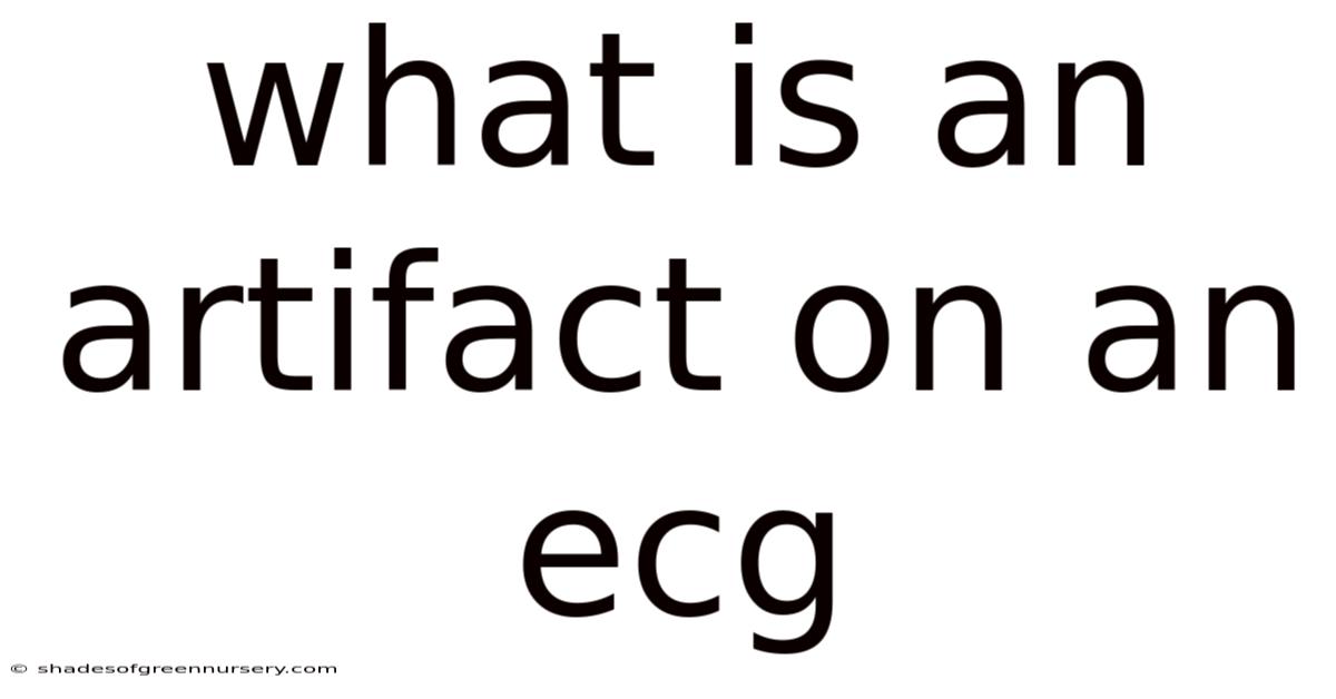 What Is An Artifact On An Ecg