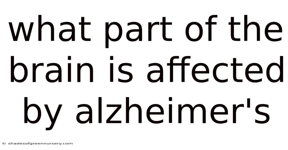What Part Of The Brain Is Affected By Alzheimer's