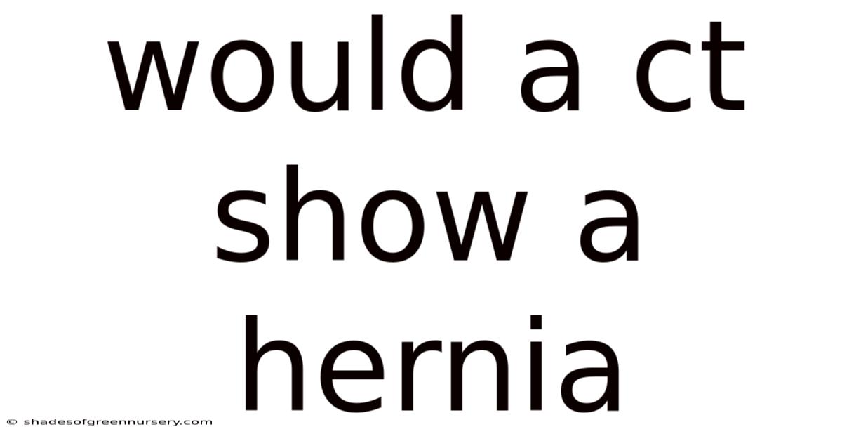 Would A Ct Show A Hernia